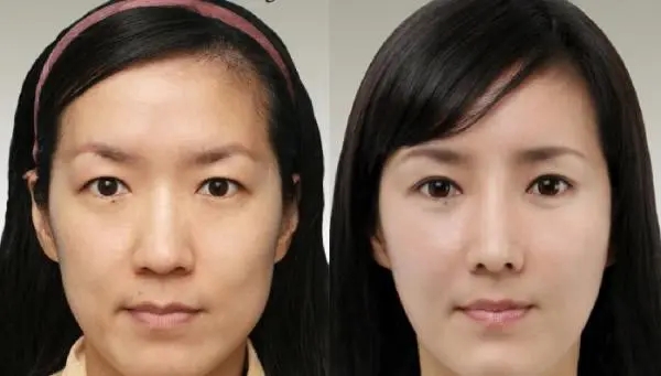 经典整形广告文案