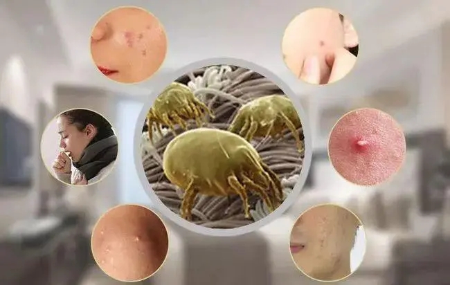 过敏的朋友圈文案