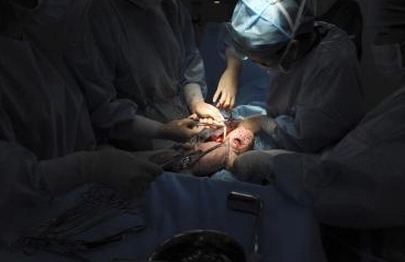 献给剖腹产的女人句子文案