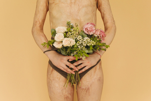 社区免费婚检有哪些项目 免费婚检有哪些项目